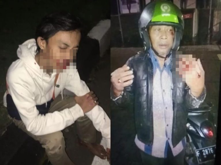 Pengendara Motor di Kota Bogor Jatuh Gara gara Tersangkut Kabel Melintang Alami Luka luka