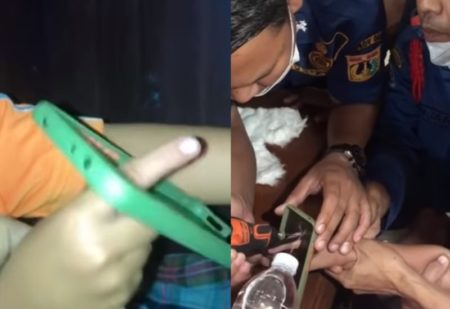 Viral Jari Telunjuk Bocah Nyangkut di Softcase HP Sulit Dilepas hingga Harus Ditangani Damkar