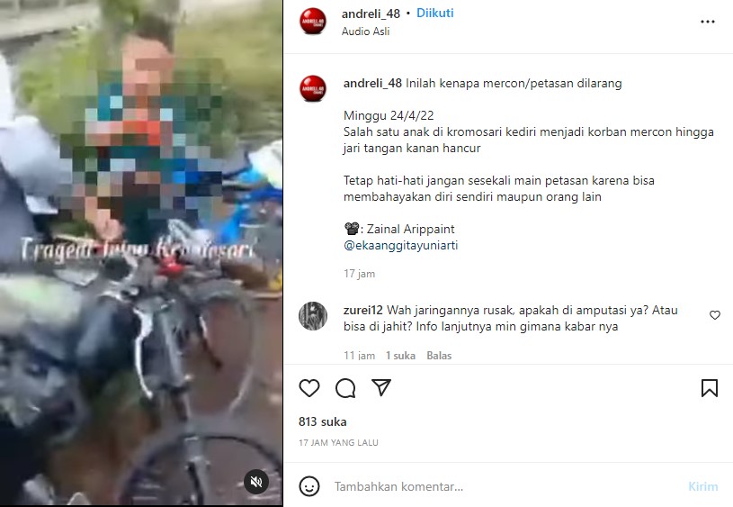 Tangkapan Layar Unggahan Video Bocah Terkena Ledakan Petasan