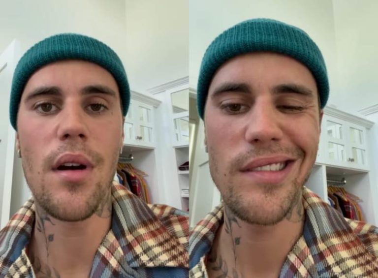 Justin Bieber Idap Ramsay Hunt Syndrome Sebabkan Separuh Wajahnya Lumpuh