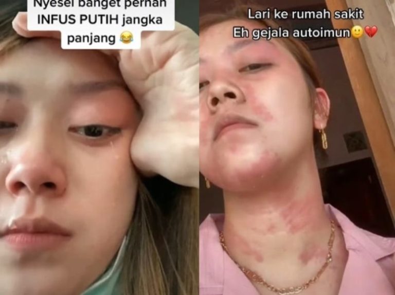 VIRAL Wanita Idap Autoimun Diklaim Lantaran Sering Suntik Putih Alami Gejala ini