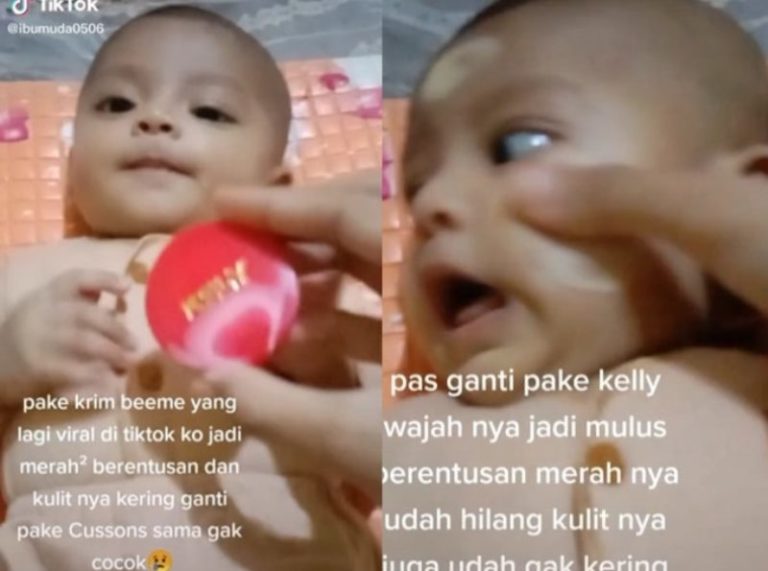 Ramai Diprotes Ibu ini Oleskan Krim Kelly ke Wajah Anaknya yang Masih Bayi