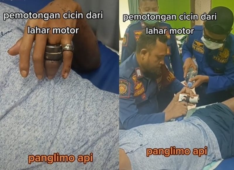 Viral Petugas Damkar Potong Cincin Laher Motor di Jari Pria ini Kondisinya Sudah Bengkak