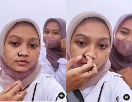 Geli Sekaligus Ngeri Ada Lintah Masuk Lubang Hidung Wanita ini