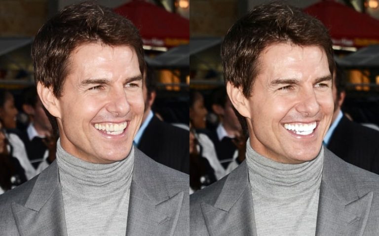 Cara Memutihkan Gigi Kuning di Foto dan Video Menggunakan CapCut Cara Memutihkan Gigi Kuning di Foto dan Video Menggunakan CapCut