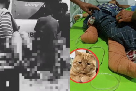 Sedih! Demi Selamatkan Kucing, Kaki Bocah SD ini Berakhir Diamputasi